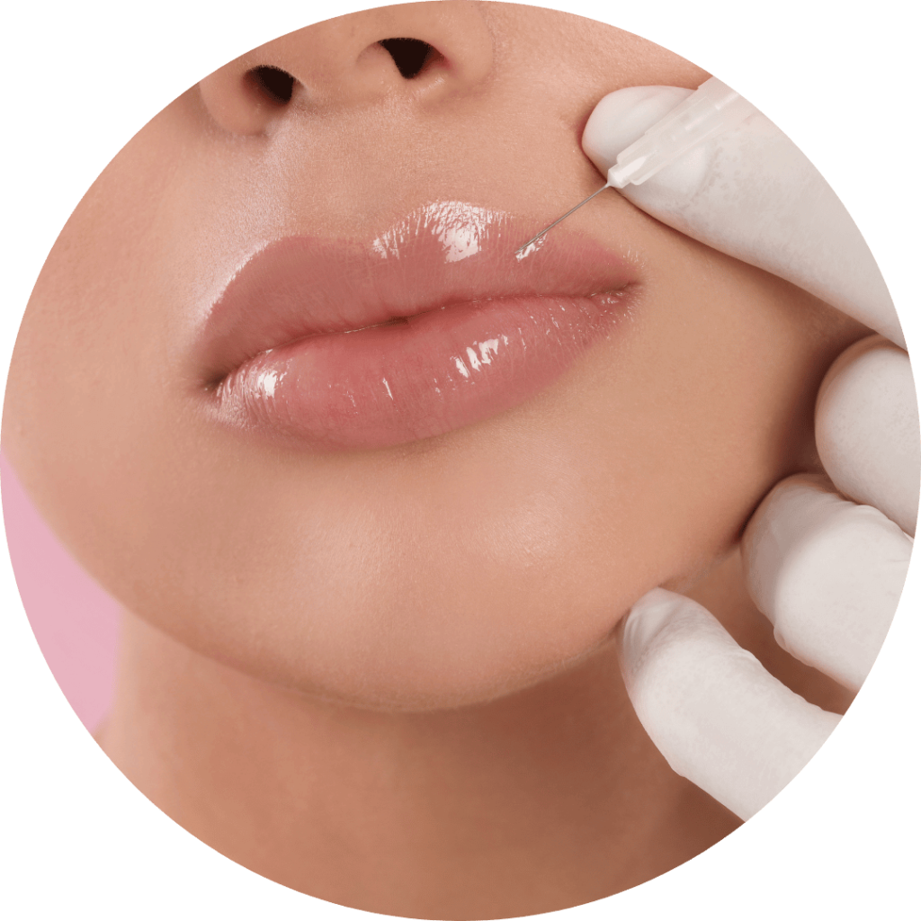 DERMAL FILLERS